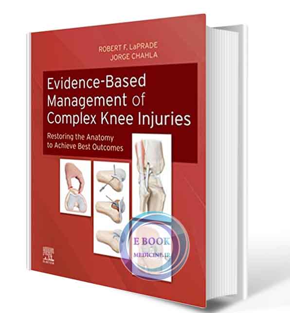 دانلود کتاب  Evidence-Based Management of Complex Knee Injuries: Restoring the Anatomy to Achieve Best Outcomes 1st 2021 ( PDF)